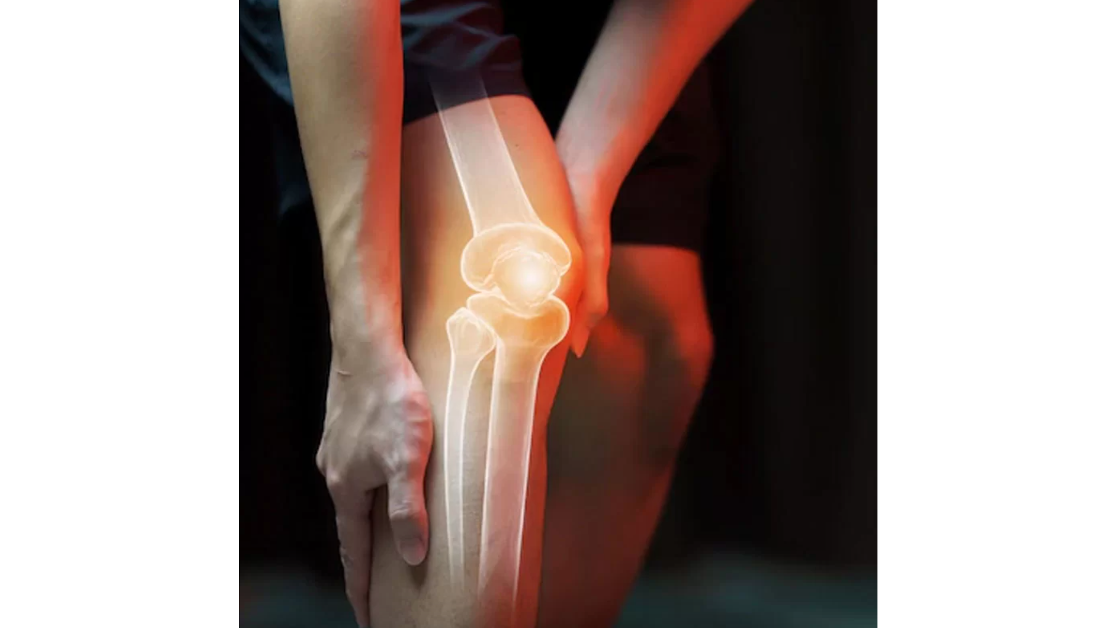 Hyaluronic Acid Injections For Knee Osteoarthritis: Why UK Experts Say They Work
