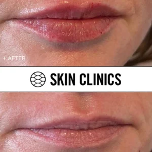 SKIN Clinics Announces Enhanced Dermatological and Aesthetic Services