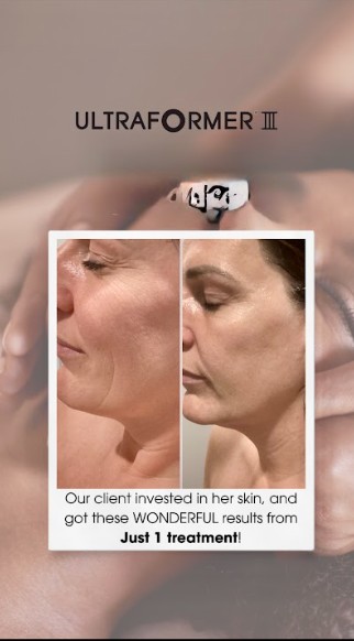 Fresh Skin Perth’s Rise From Boutique Salon to Trusted Skin Clinic – Ardross HIFU Treatment Driving Client Demand Across Perth